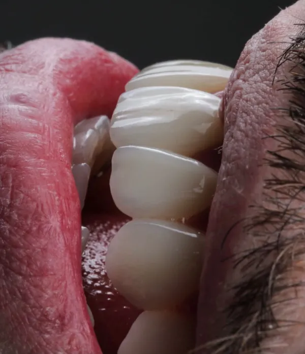Fotografia macro de cerâmica dental com textura e translucidez naturais